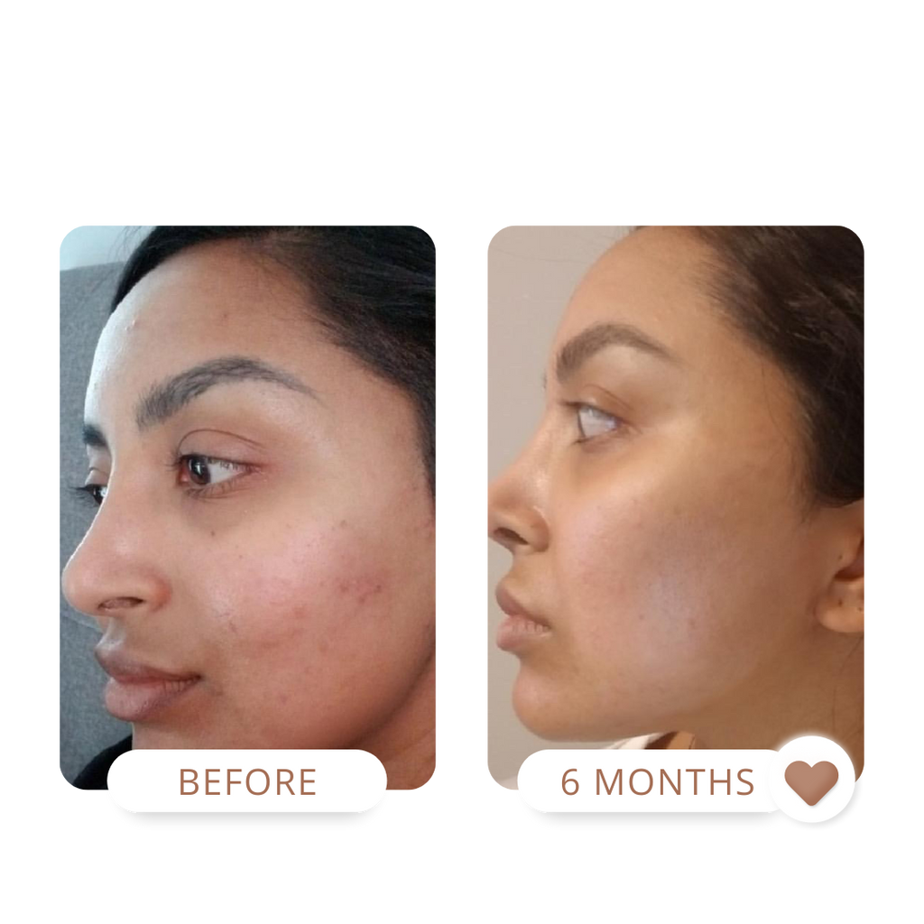 sensitive skin, turmeric face mask, glow mask 