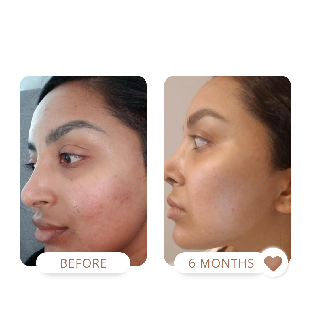 sensitive skin, turmeric face mask, glow mask 